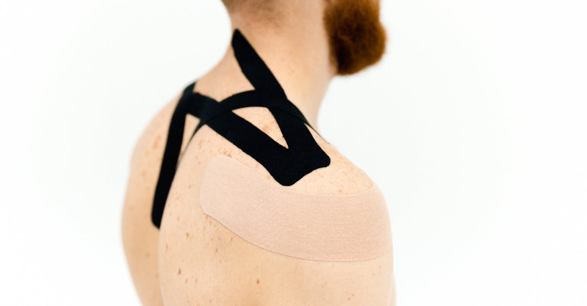 Frozen Shoulder (Adhesive Capsulitis): causes and mobility exercises